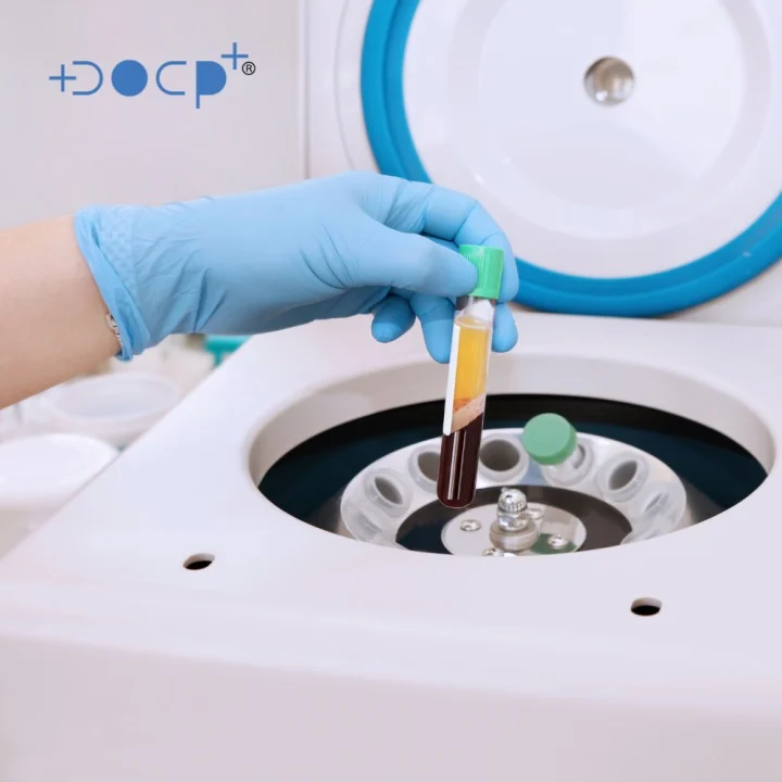 prp blood centrifuge treatment process